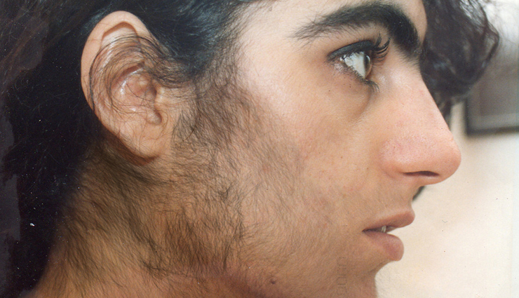 fennel,health benefits of fennel,Health tips,fitness tips