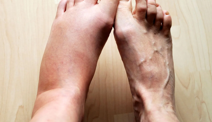 fennel seeds,health benefits of fennel seeds,Health tips,fitness tips