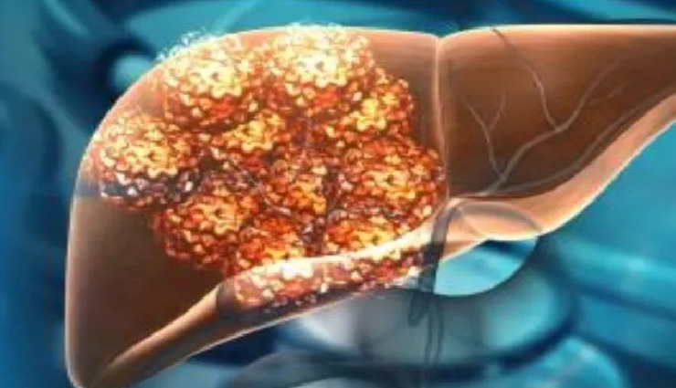 anaplastic thyroid cancer,small bowel adenocarcinoma,fibrolamellar hepatocellular carcinoma,gynaecological sarcoma,salivary gland cancer,thymoma,penile cancer,relapsed metastatic anal cancer,ocular melanoma