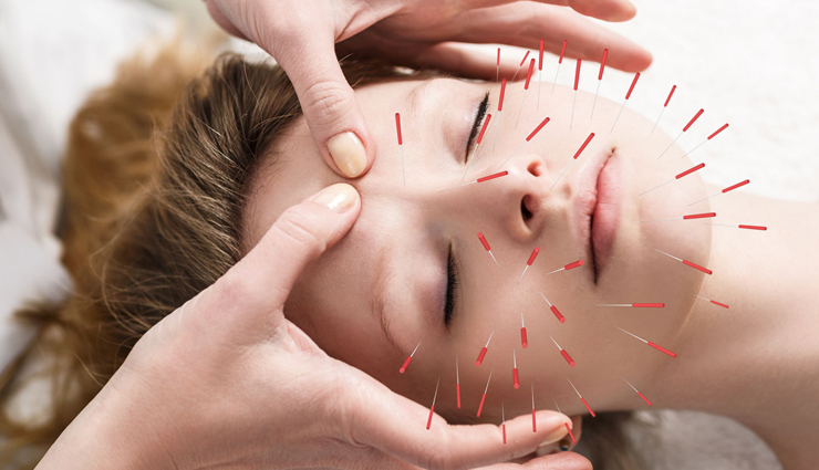 fibromyalgia,home remedies for fibromyalgia,Health tips,fitness tips