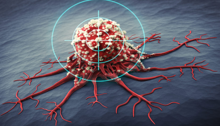 ways to fight cancer,Health tips,fitness tips