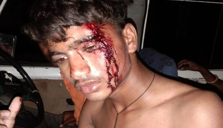 बांसवाड़ा : खूनी जंग में तब्दील हुआ पानी के लिए उठा विवाद, दो गुटों के 33 लोगों के खिलाफ मुकदमा 
