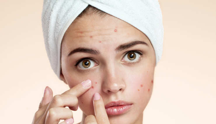 beet root,beauty benefits of beet root,beet root benefits,vitamin c,manganese,potassium,fights acne,brightens lips,prevents hair loss,makes skin clear and radiant,skin benefits,beauty benefits,beauty tricks,beauty hacks,simple beauty tips