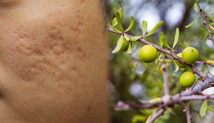 argan oil,argan oil benefits,argan oil beauty benefits,argan tree,nourishes dry skin,eases oily skin discomforts,lightens ugly stretch marks,fights acne and its scars,beauty,beauty tips