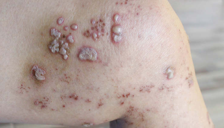 health benefits of eating figs,figs and health benefits,nutritional benefits of figs,eating figs for health,fig health benefits list,benefits of figs for your health,figs nutrition benefits,why eat figs for health,antioxidants in figs,vitamins in figs,minerals in figs,dietary fiber in figs,phytonutrients in figs,digestive health benefits of figs,cardiovascular benefits of figs,weight management with figs,skin benefits of figs,immune-boosting properties of figs