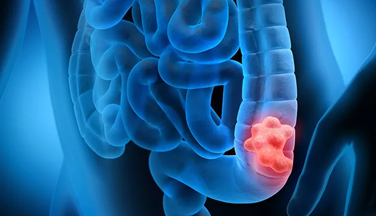 health benefits of eating figs,figs and health benefits,nutritional benefits of figs,eating figs for health,fig health benefits list,benefits of figs for your health,figs nutrition benefits,why eat figs for health,antioxidants in figs,vitamins in figs,minerals in figs,dietary fiber in figs,phytonutrients in figs,digestive health benefits of figs,cardiovascular benefits of figs,weight management with figs,skin benefits of figs,immune-boosting properties of figs