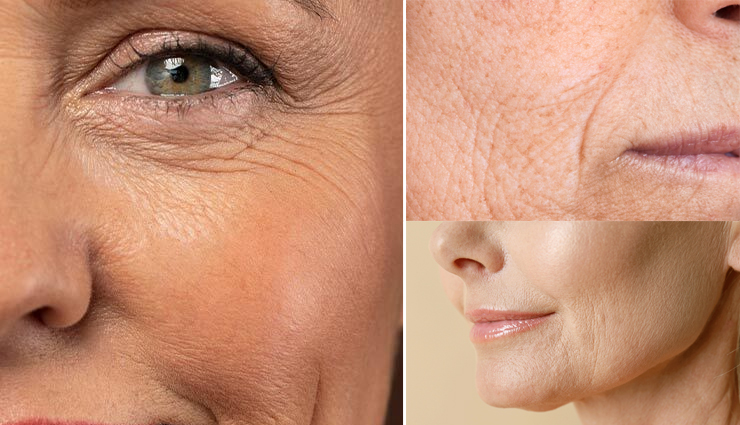 8 DIY Ways To Treat Fine Line and Wrinkles on Face