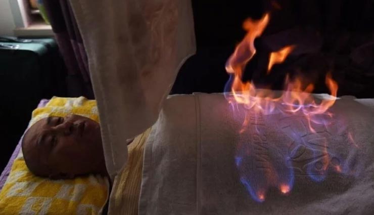 यहां शरीर पर आग लगाकर किया जाता हैं कई गंभीर बिमारियों का इलाज, विवादों में रही हैं यह थेरेपी