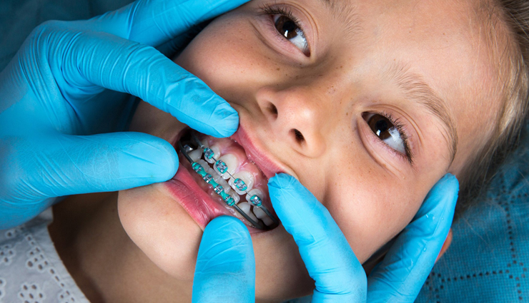 braces,child ready for braces,ways to get your child ready for braces,teeth health,Health,Health tips