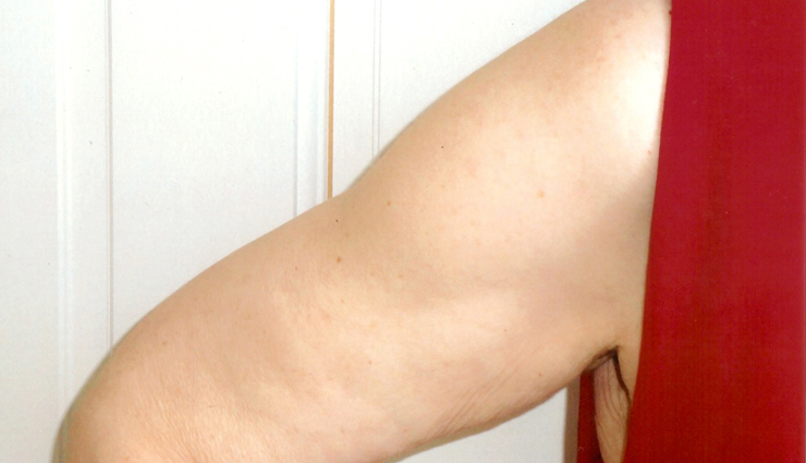 reshape flabby upper arm,diet plan for flabby upper arms,tips to get rid of upper arm fat,fitness tips,Health tips