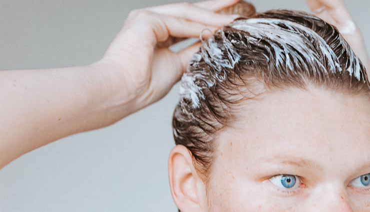 flaky scalp,ways to get rid of flaky scalp,home remedies for flaky scalp,scalp care tips,hair care tips,beauty tips