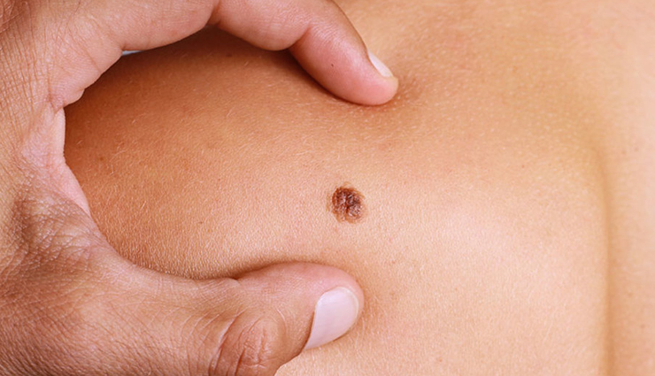 flax seeds,beauty benefits of flax seeds,skin care tips,beauty tips