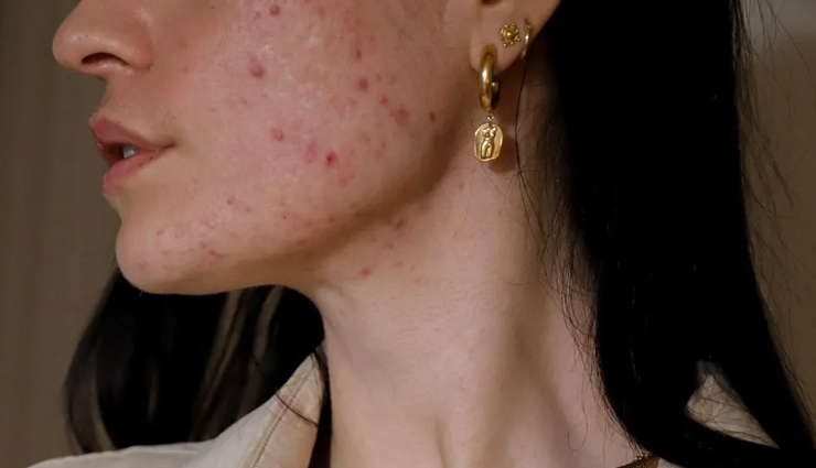 flaxseeds,flaxseeds for skin,beauty benefits of flaxseeds,skin care tips,beauty tips