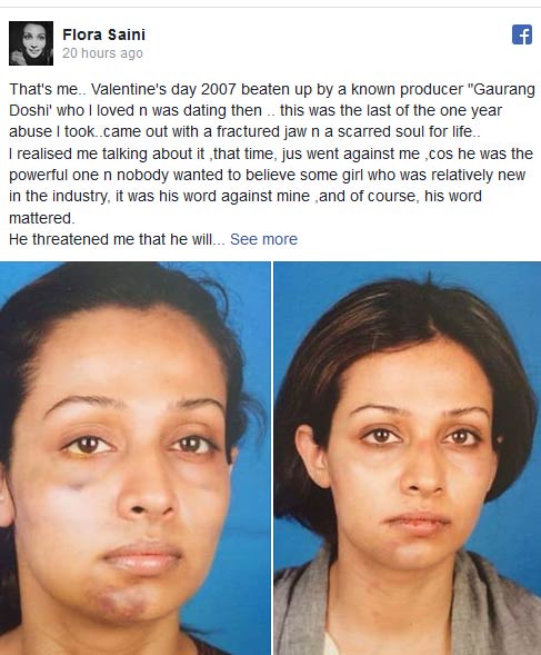 metoo,jwala gutta,badminton,tanushree dutta,nana patekar,mental harassment