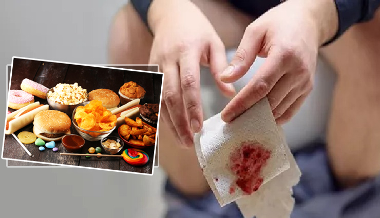 10 Foods to Avoid During Piles Problem