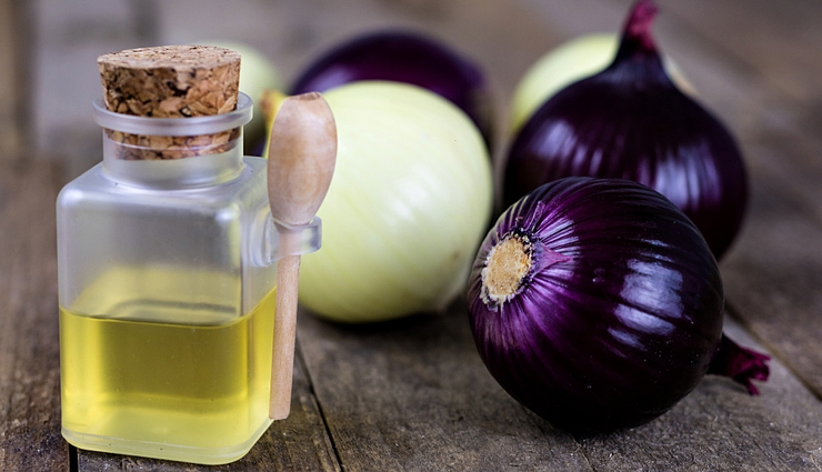 aloe vera,yogurt,egg olive oil and honey,amla,onion juice,effective remedies to grow hair on forehead,hair on forehead,hair care tips,beauty tips,summer tips