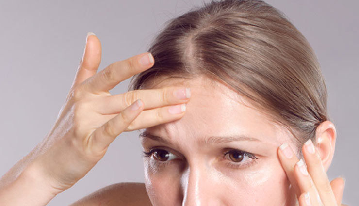 home remedies,home remedies for forehead wrinkles,forehead wrinkles,skin care tips,beauty tips