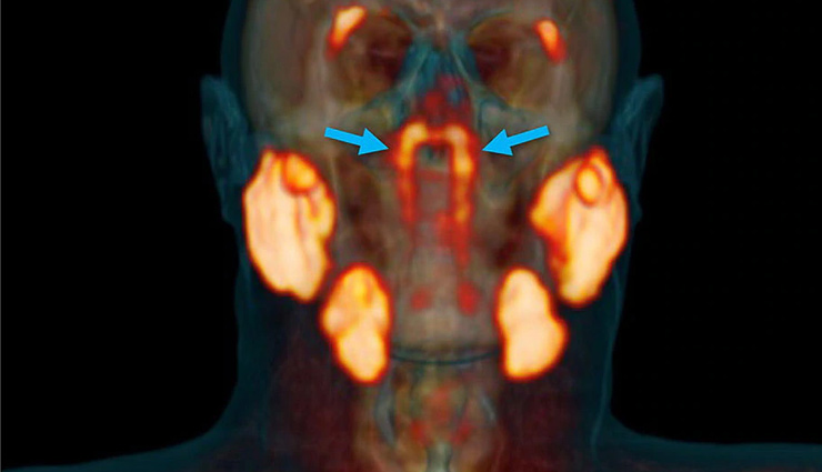 वैज्ञानिकों की बड़ी खोज, इंसान के शरीर में मिला नया अंग