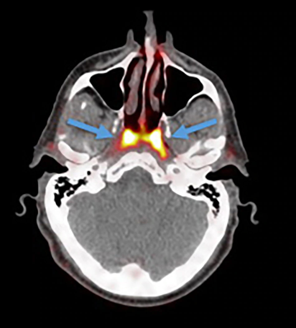 netherlands scientists,new organ,human body,news,world news