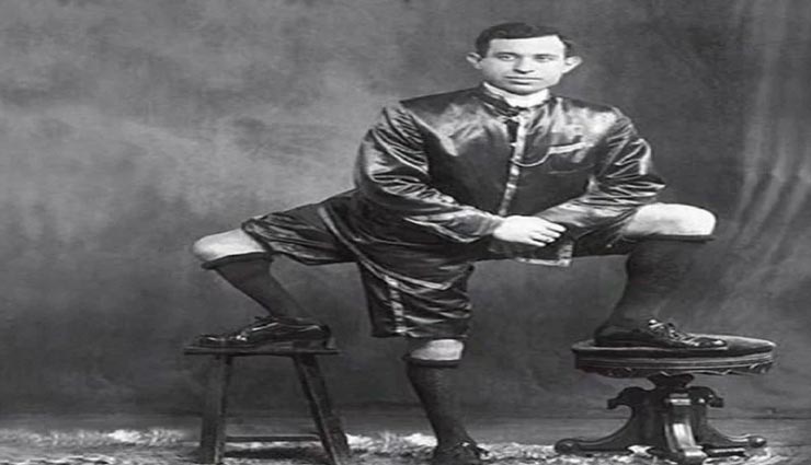 इस तीन टांगों वाले व्यक्ति ने पूरी दुनिया को किया 77 साल तक हैरान