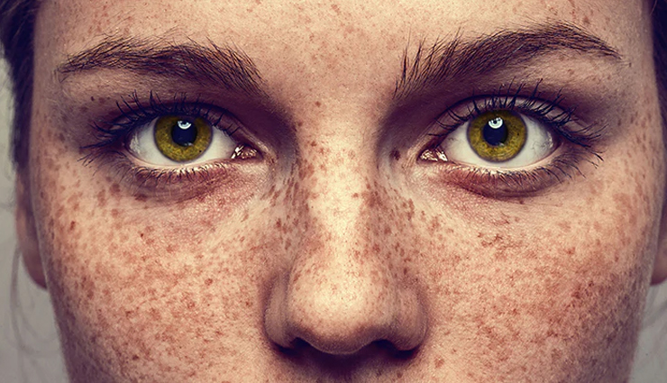 diy remedies for freckle lightening,natural ways to lighten freckles,home remedies for reducing freckles,how to lighten freckles naturally,gentle diy solutions for freckle lightening,diy freckle treatment options,homemade remedies to lighten freckles,tips for lightening freckles with diy methods,natural remedies to fade freckles,diy freckle lightening techniques