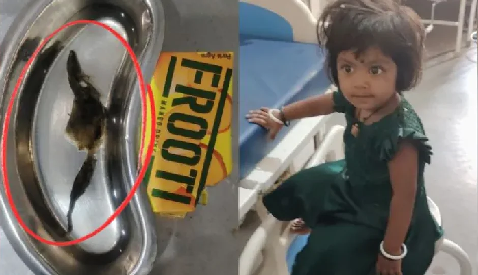 हैरान कर देगा मामला! मैंगो जूस के पैकेट में निकला सांप जैसा पदार्थ, पीते ही बीमार हुई 3 साल की बच्ची