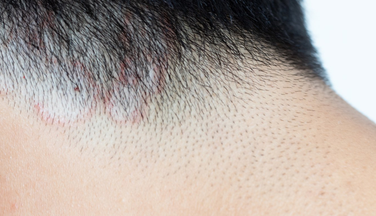 hair oil,oiling,oiling benefits,scalp care tips,hair care tips,hair care,beauty,beauty tips