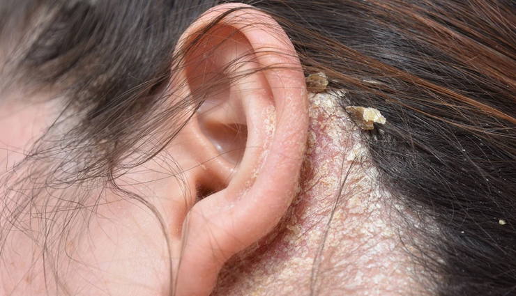 benefits of nagarmotha,nagarmotha benefits,nagarmotha benefits for hair,nagarmotha benefits for skin,nagarmotha benefits in hindi,nagarmotha benefits for hair in hindi,nagarmotha benefits for hair growth,nagarmotha medicinal uses,nagarmotha oil benefits for hair,nagarmotha herb benefits,nagarmotha for skin,beauty tips,beauty hacks