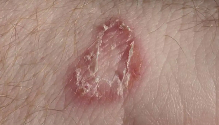 irish moss health benefits,sea moss benefits,health benefits of sea moss,irish moss superfood,benefits of irish moss for skin,irish moss immune system,irish moss digestion,irish moss anti-inflammatory,irish moss vitamins and minerals,irish moss for healthy hair and nails