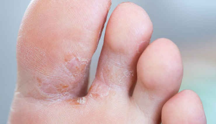 kojic acid benefits,skin lightening with kojic acid,kojic acid for dark spots,hyperpigmentation treatment,kojic acid skincare,brightening effects of kojic acid,kojic acid and skin discoloration,natural skin lightening ingredient,kojic acid cream,kojic acid soap