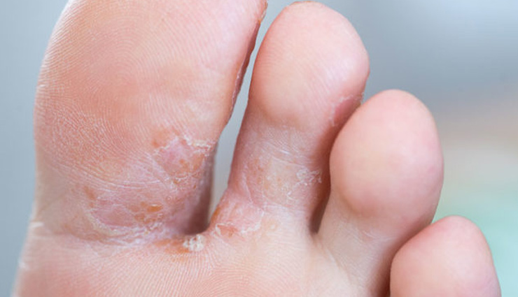 ajwain health benefits,benefits of ajwain seeds,ajwain for digestion,ajwain for respiratory health,ajwain antimicrobial properties,ajwain for weight management,ajwain for blood pressure,ajwain menstrual pain relief,ajwain for skin health,ajwain for oral health,ajwain for parasites,carom seeds benefits,health benefits of carom seeds,ajwain nutritional benefits,medicinal uses of ajwain,ajwain traditional remedies,ajwain oil benefits,how to use ajwain for health,ajwain for stomach issues,ajwain anti-inflammatory properties