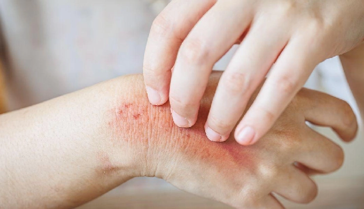 star anise benefits,star anise spice,indian spices,chinese spices,star anise nutrition,star anise in cooking,herbal tea ingredients,star anise health properties,chinese star anise,biryani spices,spices with vitamins,aromatic spices,culinary spices,medicinal spices,toxic star anise varieties