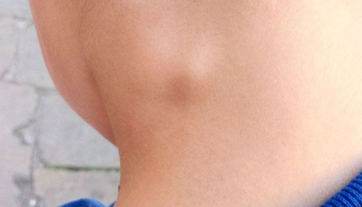 आम बात है मुँह का कैंसर होना, समय रहते किए गए इलाज से बचाया जा सकता है स्वयं को mouth cancer causes,oral cancer risk factors,tobacco and mouth cancer,alcohol and oral cancer,hpv and mouth cancer,sun exposure and lip cancer,unhealthy diet and mouth cancer,chewing tobacco and oral cancer,mouth cancer prevention,oral health and cancer development