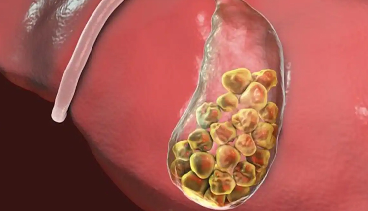 Peanut butter,health benefits of consuming peanut butter,peanut butter healthy food,peanut butter benefits,peanut butter health benefits,peanut butter healthy life,Health,Health tips