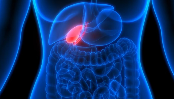 gallstone pain relief,gallstone treatment options,natural remedies for gallstones,effective relief for gallstone pain,surgical treatment for gallstones,home remedies for gallstone pain,gallstone removal techniques,minimally invasive treatment for gallstones,gallstone diet and prevention,alternative therapies for gallstones,non-surgical treatment for gallstones,herbal remedies for gallstone relief,managing gallstone symptoms,gallstone pain management strategies,lifestyle changes for gallstone prevention