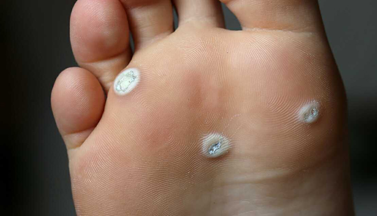 garlic,health benefits of garlic,Health tips,fitness tips