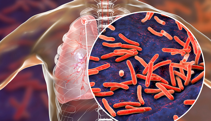 drinking garlic juice benefits,health benefits of garlic juice,garlic juice advantages for health,why garlic juice is good for health,benefits of consuming garlic juice,garlic juice for wellness,garlic extract health benefits,drinking raw garlic juice advantages,natural remedies with garlic juice,garlic juice health impact