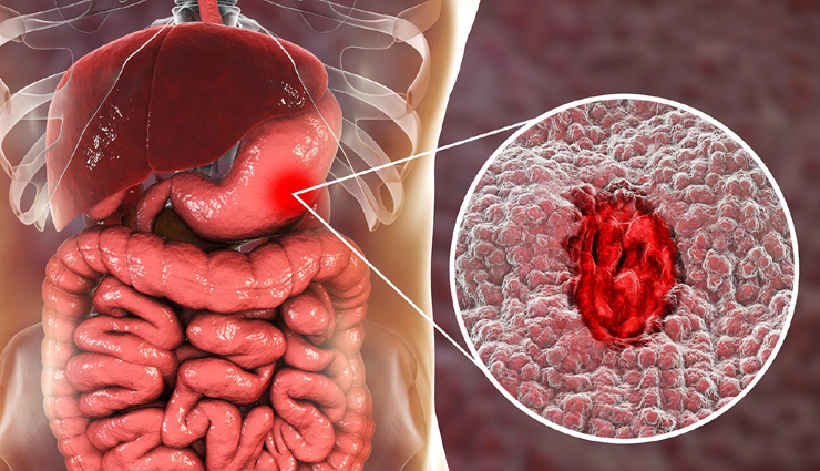 chewing paan benefits,chewing betel leaves benefits,betel leaves,paan improves digestion,paan good oral hygiene,paan treats gastric ulcers,paan cures boils,paan treats diabetes,paan cures constipation,paan relieves headache,Health,Health tips,simple health tips