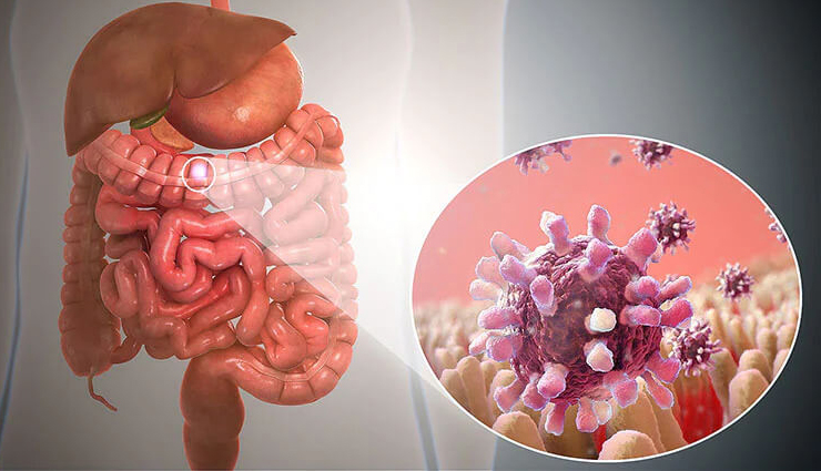 10 Home Remedies To Treat Gastroenteritis