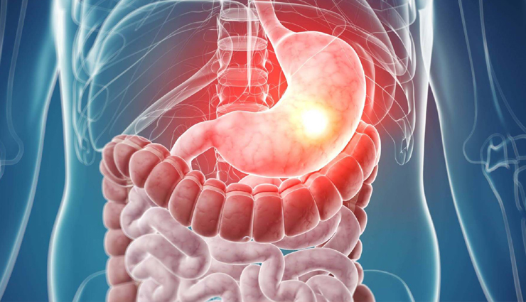 chronic complication,uncontrolled diabetes,nerve damage,kidney damage,eye damage,coronary heart disease,stroke,hypertension,peripheral vascular,disturbances in liver,lung disease,gastrointestinal disorders,Health,Health tips