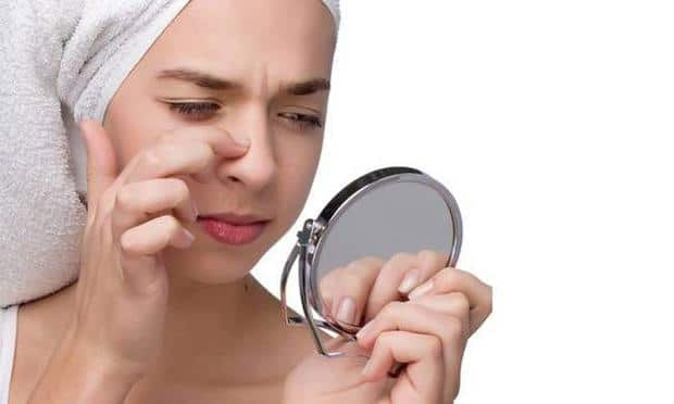 ways to get rid of acne,home remedies to get rid of pimples,acne,skin care tips,beauty tips,valentines special,valentines special 2018