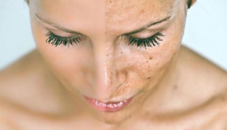 home remedies for black spots on face,beauty tips for black spots on face,beauty tips