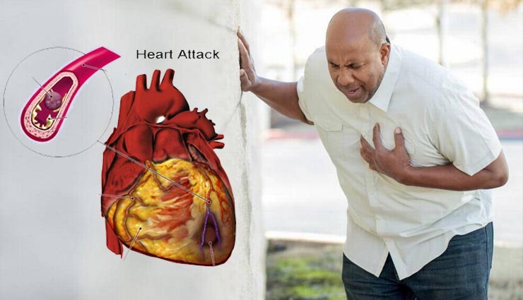 heart attack,Health tips,healthy living