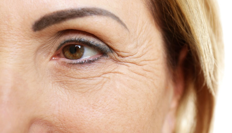 home remedies,home remedies to get rid of wrinkles,wrinkles,skin care tips,beauty tips