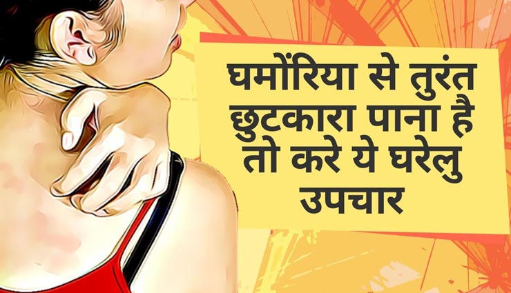 गर्मियों में पनपती हैं घमौरियां, इन घरेलू उपायों से मिलेगी राहत 
