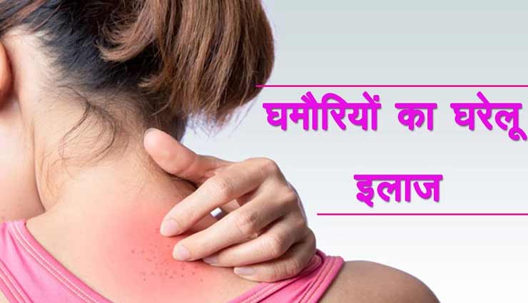 होने लगी हैं घमौरियां की शिकायत, इन देसी उपायों से मिलेगी राहत