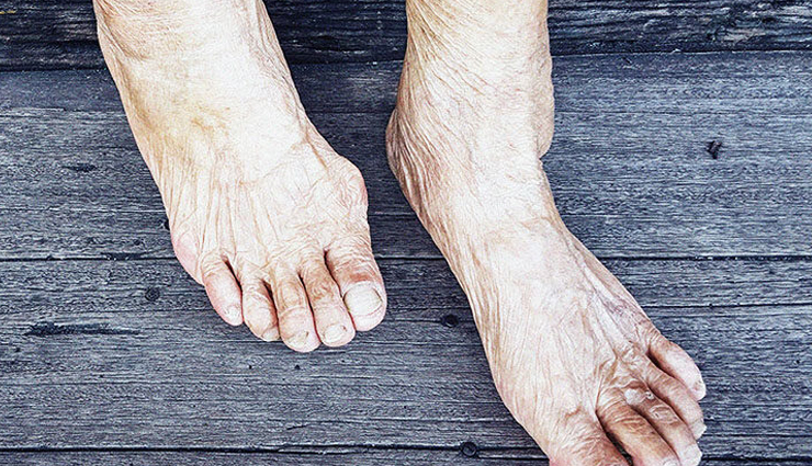 ginger health benefits,medicinal properties of ginger,anti-inflammatory effects of ginger,ginger for nausea relief,ginger for weight loss,ginger for osteoarthritis,ginger for lowering blood sugars,traditional uses of ginger,ginger in chinese medicine,ginger in indian medicine,history of ginger use,ancient medicinal ginger,bioactive compounds in ginger,gingerols in ginger,aromatic properties of ginger,ginger as a tonic,ginger root benefits,ginger spice health benefits,ginger tea benefits,ginger supplements