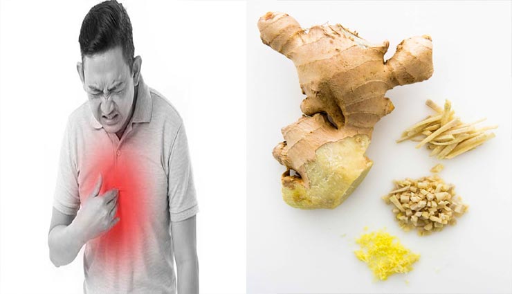 Health tips,health tips in hindi,acidity,acidity remedies,home remedies