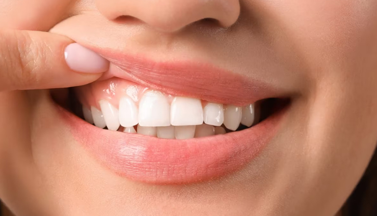 ginger is considered a superfood in ayurveda it cures many health problems,Health,healthy living