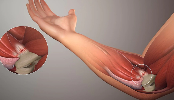 ginger is considered a superfood in ayurveda it cures many health problems,Health,healthy living